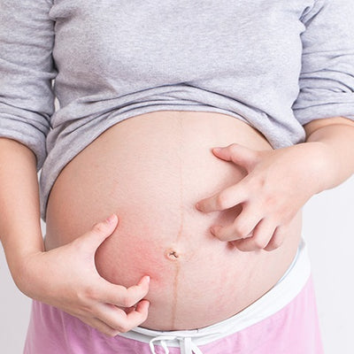 Itching in Pregnancy